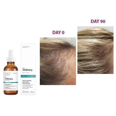 The Ordinary Multi-Peptide Serum for Hair Density - Rougecosmetics